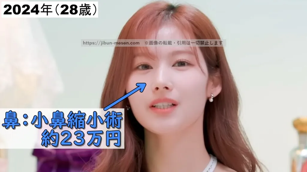 TWICEサナが整形した箇所とその費用