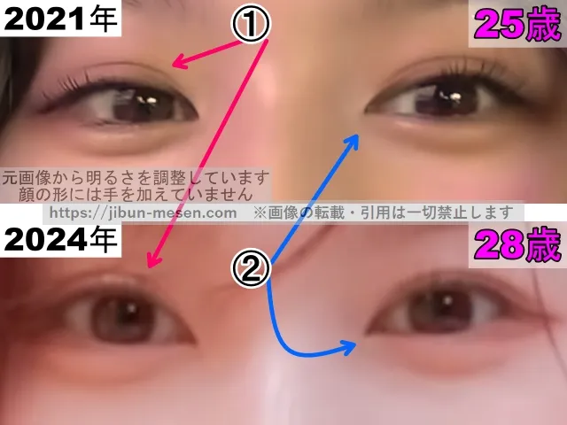 TWICEサナの目の整形検証2021年〜2024年（拡大）