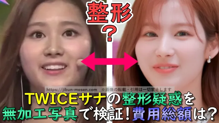 TWICEサナの整形疑惑を無加工写真で検証！費用総額は？