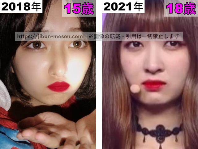 LIMELIGHTみゆの唇の整形検証2018年〜2021年の画像