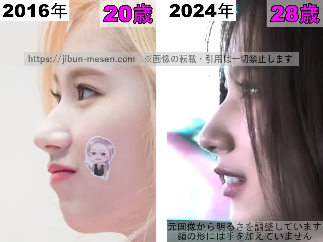 TWICEサナの鼻の整形検証2016年〜2024年