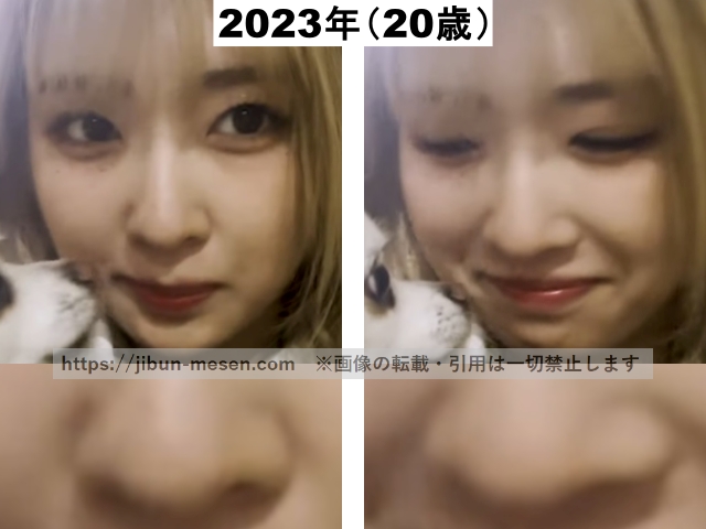 LIMELIGHTみゆの小鼻の比較の画像