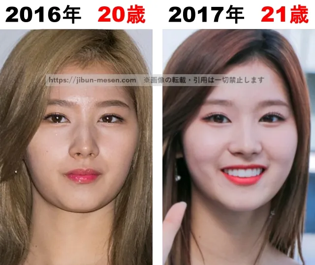 TWICEサナの整形検証2016年〜2017年