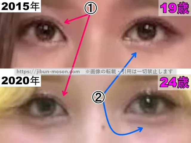 TWICEサナの目の整形検証2015年〜2020年（拡大）