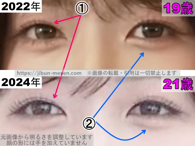 LIMELIGHTみゆの目の整形検証2022年〜2024年(拡大)の画像