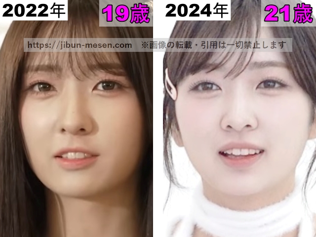 LIMELIGHTみゆの目の整形検証2022年〜2024年の画像