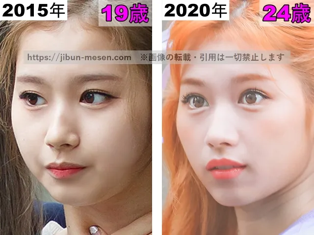 TWICEサナの鼻の整形検証2015年〜2020年