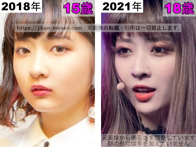 LIMELIGHTみゆの目の整形検証2018年〜2021年の画像