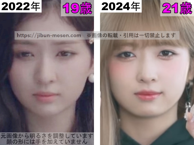 LIMELIGHTみゆの唇の整形検証2022年〜2024年の画像