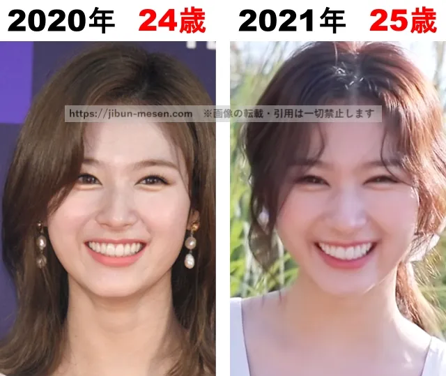 TWICEサナの整形検証2020年〜2021年