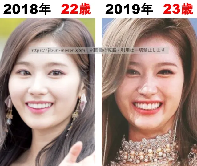 TWICEサナの整形検証2018年〜2019年