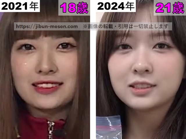 LIMELIGHTみゆの鼻の整形検証2021年〜2024年の画像