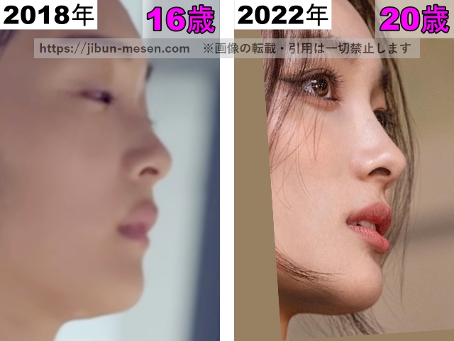 XGジュリンの鼻の整形検証2018年〜2022年の画像