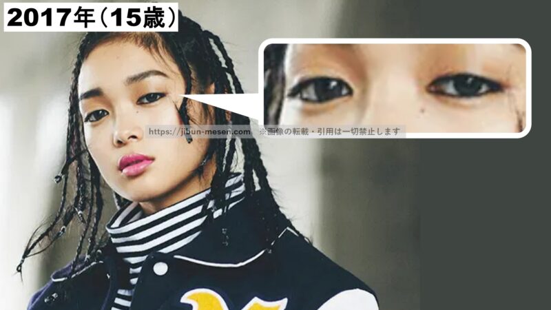 XGジュリンの二重まぶた２の画像