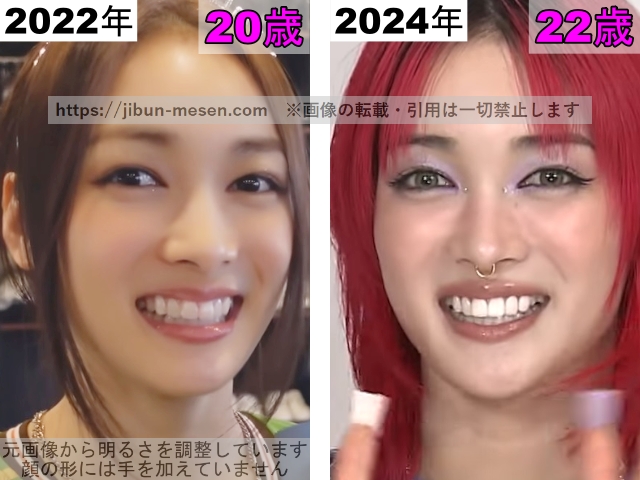 XGジュリンの目の整形検証2022年〜2024年の画像