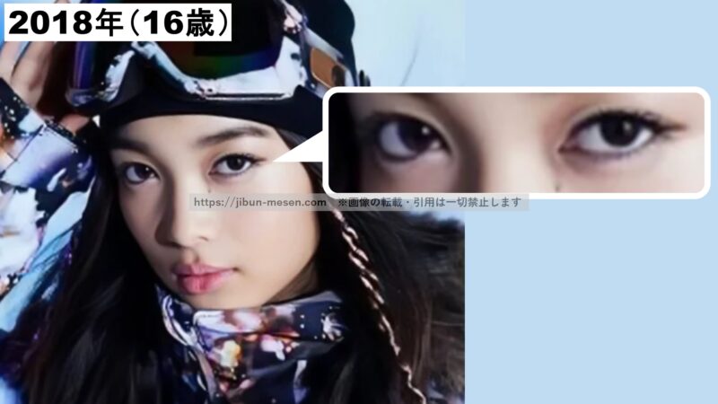 XGジュリンの目頭の画像