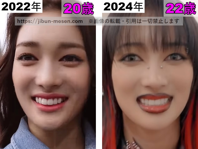 XGジュリンの鼻の整形検証2022年〜2024年の画像