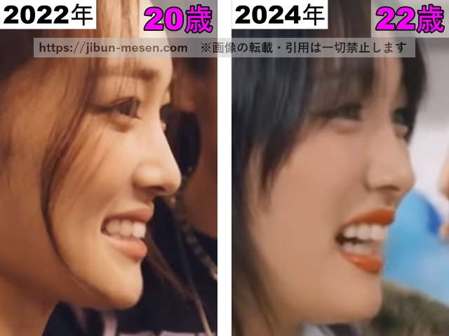 XGジュリンの鼻の整形検証2022年〜2024年（横顔）の画像