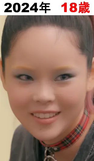 XGココナの整形検証2024年