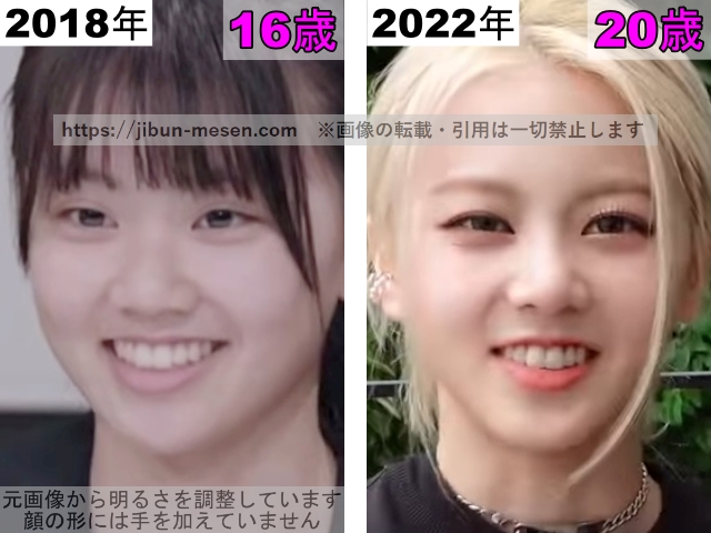 XGヒナタの唇の整形検証2018年〜2022年の画像