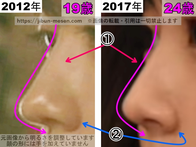 有村架純の鼻の整形検証2012年〜2017年（横顔・拡大）の画像