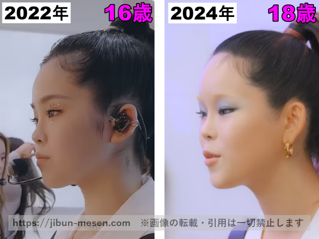 XGココナの鼻の整形検証2022年〜2024年（横顔）の画像