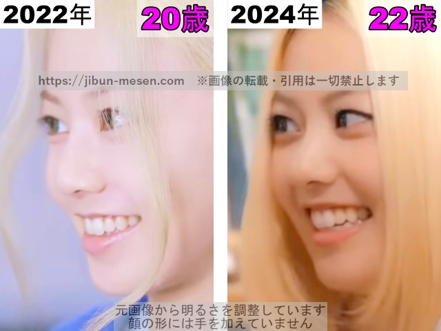 XGヒナタの唇の整形検証2022年〜2024年（横顔）の画像