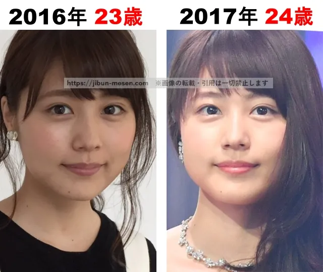 有村架純の整形検証2016年〜2017年