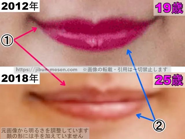 有村架純の唇の整形検証2012年〜2018年（拡大）