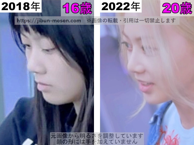 XGヒナタの鼻の整形検証2018年〜2022年（横顔）の画像