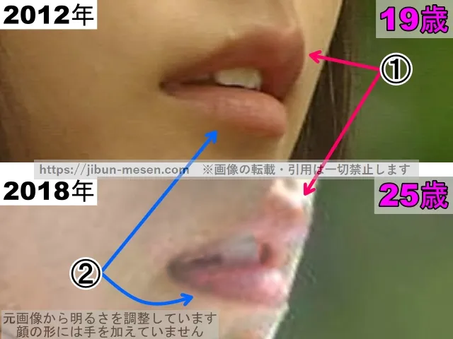 有村架純の唇の整形検証2012年〜2018年（横顔・拡大）