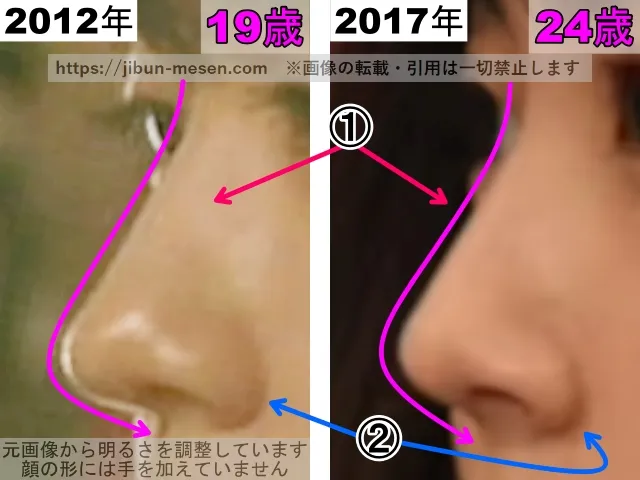 有村架純の鼻の整形検証2012年〜2017年（横顔・拡大）
