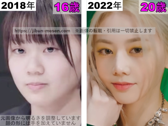 XGヒナタの鼻の整形検証2018年〜2022年の画像