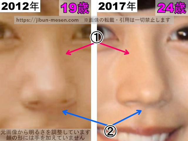 有村架純の鼻の整形検証2012年〜2017年（拡大）の画像