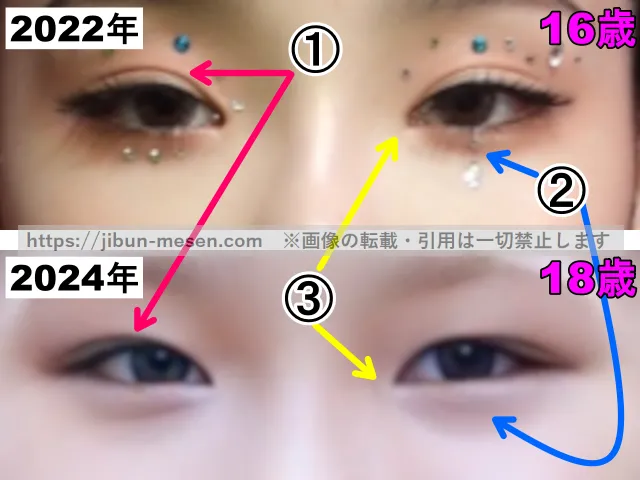 XGココナの目の整形検証2022年〜2024年（拡大）