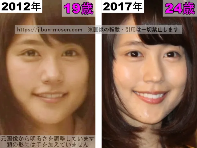 有村架純の鼻の整形検証2012年〜2017年