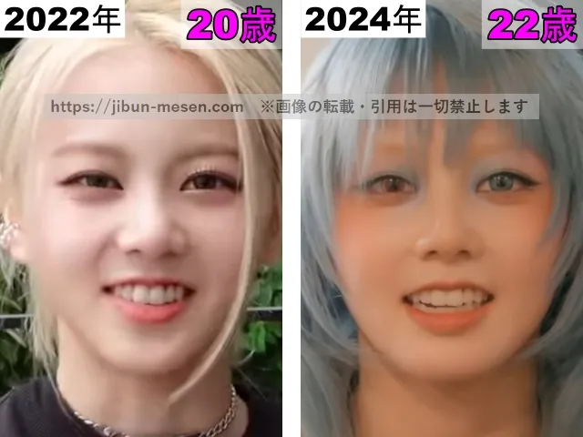 XGヒナタの鼻の整形検証2022年〜2024年