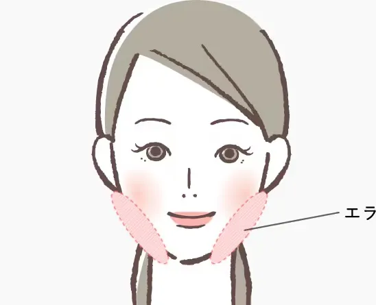 エラの説明（湘南美容クリニックHPより引用）