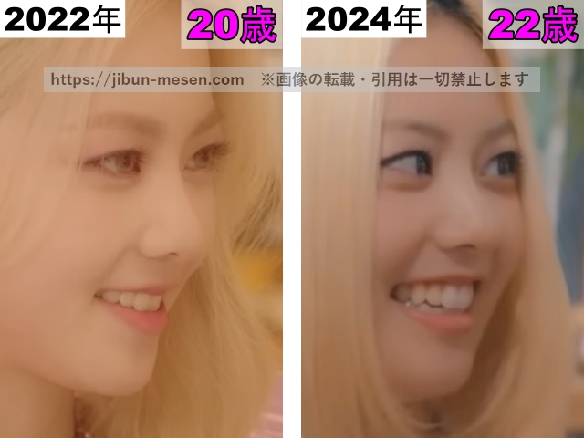 XGヒナタの鼻の整形検証2022年〜2024年（横顔）の画像