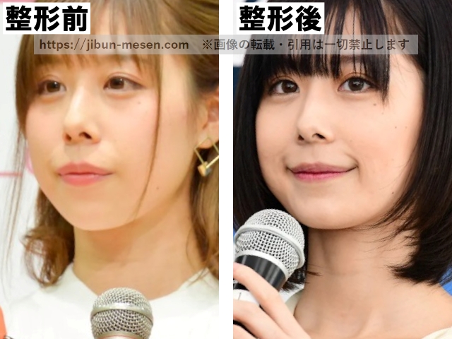 有村藍里の整形前と整形後の比較の画像
