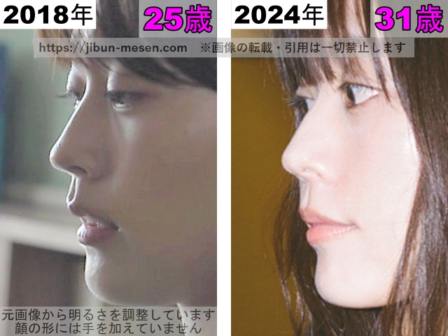 有村架純の鼻の整形検証2018年〜2024年（横顔）の画像