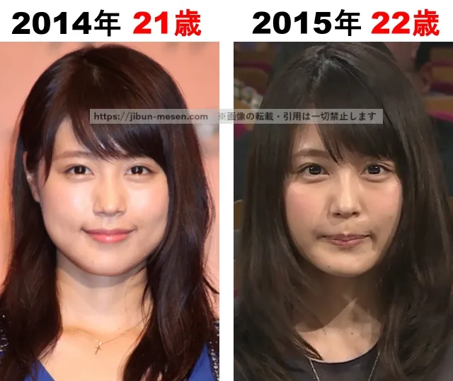 有村架純の整形検証2014年〜2015年