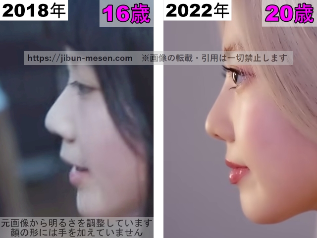 XGヒナタの唇の整形検証2018年〜2022年（横顔）の画像