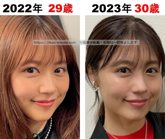 有村架純の整形検証2022年〜2023年