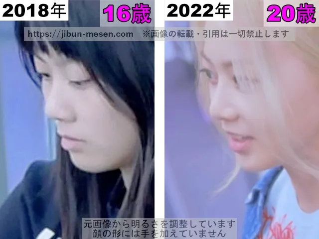 XGヒナタの鼻の整形検証2018年〜2022年（横顔）