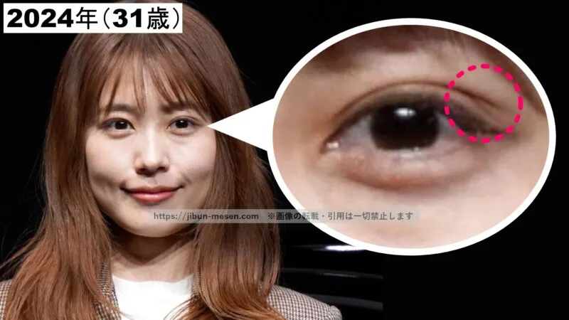 二重の端にシワがある有村架純