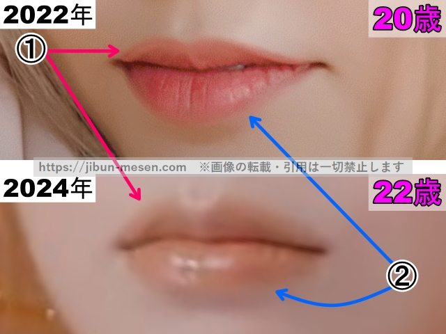XGヒナタの唇の整形検証2022年〜2024年（拡大）の画像