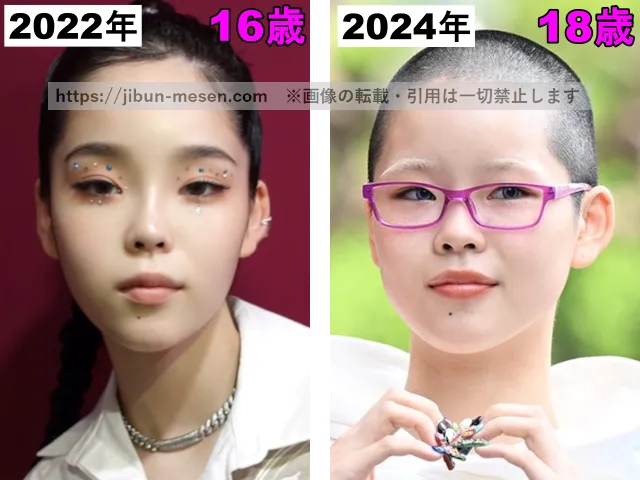 XGココナの口の整形検証2022年〜2024年