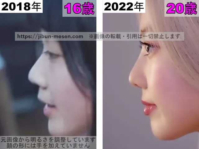 XGヒナタの唇の整形検証2018年〜2022年(横顔)