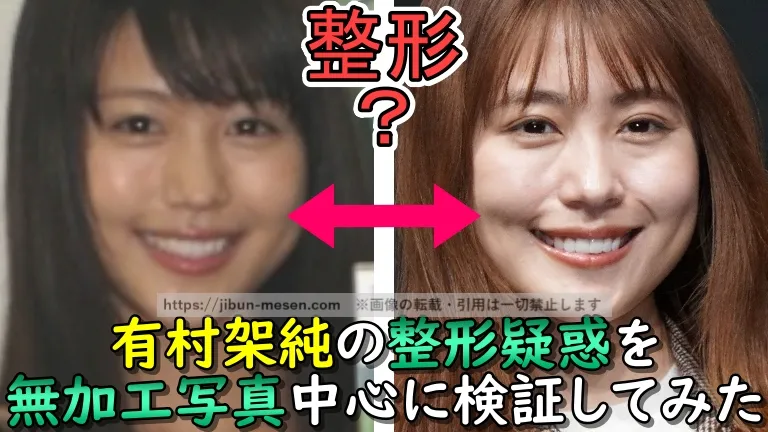 有村架純の整形疑惑を無加工写真中心に検証してみた